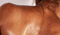 Close‑up of a sweaty back with visible moisture droplets symbolising heavy sweating