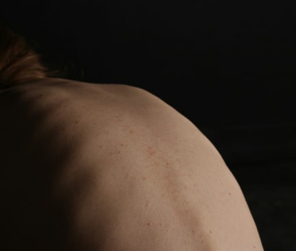 Close‑up of a human back in dim light; symbolic image for the topic best sleeping position for acute lower‑back pain